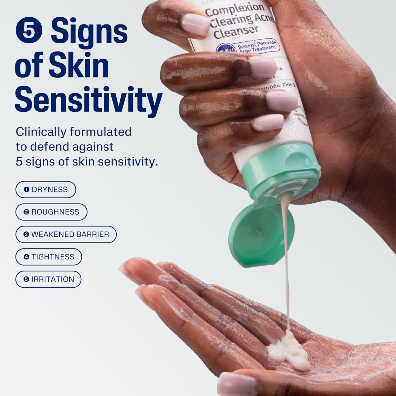 Cetaphil Gentle Clear Complexion-Clearing BPO Acne Cleanser with 2.6% Benzoyl Peroxide, Creamy and Soothing for Sensitive Skin, Suitable for All Skin Types, 4.2oz