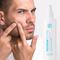 Thumbnail for BRIOTECH Skin Renew Toner, Hypochlorous Acid Spray Topical Skin Spray for Face and Skin, Minimize Appearance of Blemishes, Soothing Mist for Redness & Bumps, 4 fl oz