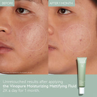 Thumbnail for Caudalie Vinopure Oil Control Moisturizer, Hydrating & Mattifying Moisturizer - 40 mL