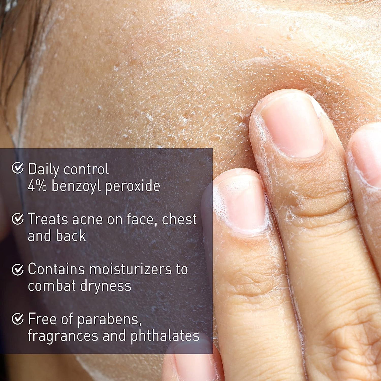 PanOxyl 4 Acne Creamy Wash, 4% Benzoyl Peroxide 6 oz (Pack of 4)