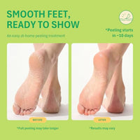 Thumbnail for Image 5 of Purederm Foot Peeling Mask for Dry Cracked Feet, Exfoliating Treatment for Dead Skin & Calluses