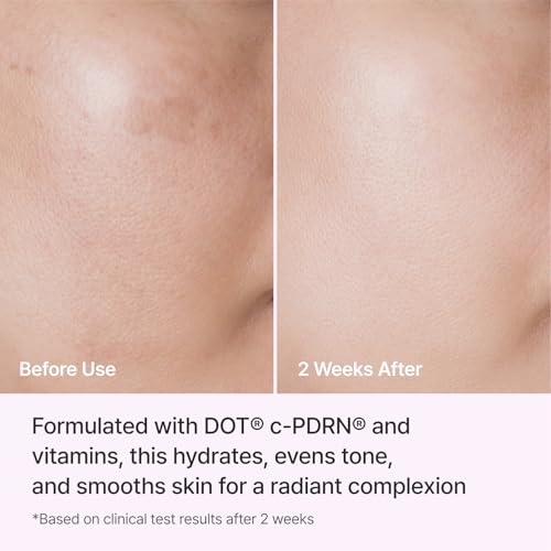 Image 5 of REJURAN Triple Radiance Cream, DOTTM c-PDRN® 0.2% Moisturizer, 1.69 fl oz