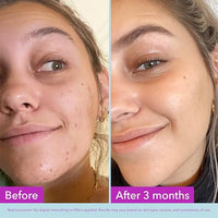 Thumbnail for Image 7 of Good Molecules Niacinamide Brightening Toner with Arbutin