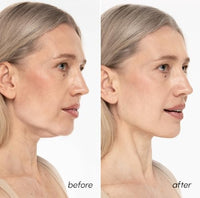 Thumbnail for Image 3 of MAREE V Line Lifting Mask 2 PACK - 24K Gold Double Chin Lifting Mask 10 Ct