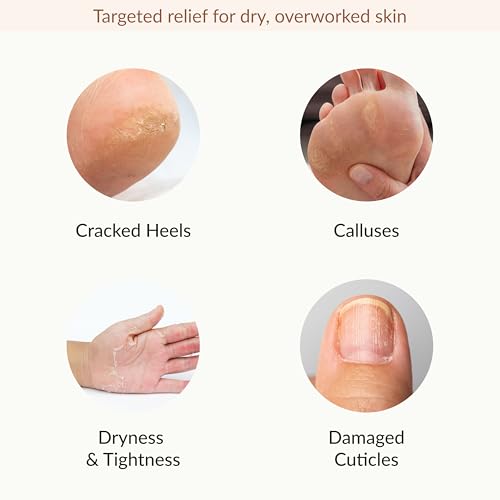 Image 4 of Epielle Hydrating & Moisturizing Hand & Foot Masks, 6 Moisturizing Gloves & 6 Moisturizing Socks