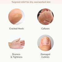 Thumbnail for Image 4 of Epielle Hydrating & Moisturizing Hand & Foot Masks, 6 Moisturizing Gloves & 6 Moisturizing Socks
