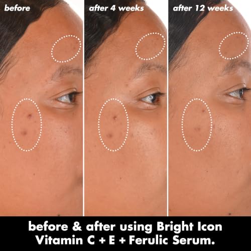 Image 3 of e.l.f. SKIN Bright Icon Vitamin C + E + Ferulic Serum, 1 oz