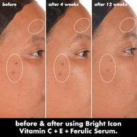 Thumbnail for Image 3 of e.l.f. SKIN Bright Icon Vitamin C + E + Ferulic Serum, 1 oz