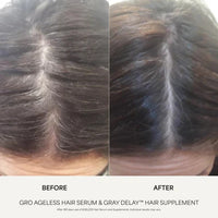 Thumbnail for Vegamour GRO AGELESS Anti-Gray Hair Serum 30ml