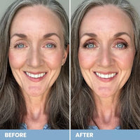 Thumbnail for Image 11 of PRIME PROMETICS PrimeEyes Eye Brightener for Mature Women