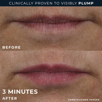 Thumbnail for RoC Derm Correxion Lip Volumizer - Lip Plumper Peptide Treatment with Hyaluronic Acid & Vitamin E + Line Smoothing Eye Cream Packette