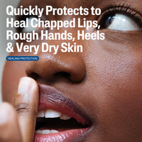 Thumbnail for Cetaphil Healing Ointment, 3 oz, For Dry, Chapped, Irritated Skin, Heals and Protects, Soothes Cracked Hands and Chapped Lips, Hypoallergenic, Fragrance Free