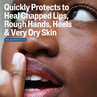 Thumbnail for CETAPHIL Healing Ointment, 3 oz, For Dry, Chapped, Irritated Skin, Heals and Protects, Soothes Cracked Hands and Chapped Lips, Hypoallergenic, Fragrance Free