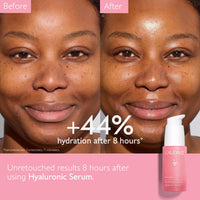 Thumbnail for Caudalie VinoHydra Hyaluronic Acid Serum, Hydrating, Soothing, Dermatologically Tested & Vegan - 30 mL