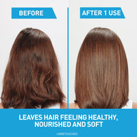 Thumbnail for CeraVe Hydrating Anti Dandruff Shampoo, 1% Pyrithione Zinc Dandruff Treatment With Ceramides, Niacinamide & Hyaluronic Acid, Helps Eliminate Flakes & Provides Itchy Scalp Relief, Sulfate Free, 12 Oz