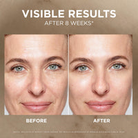 Thumbnail for L'Oreal Paris Age Perfect Anti-Aging Midnight Cream, Face Moisturizer to Reduce Wrinkles and Firm Skin, 1.7oz + Serum Sample