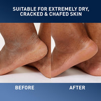 Thumbnail for CeraVe Healing Ointment, Hydrating Skin Protectant With Petrolatum, Hyaluronic Acid & Ceramides, Face & Body Skin Barrier Repair For Cracked, Chafed, Dry Skin, Fragrance Free & Lanolin Free, 5 Oz