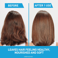 Thumbnail for CeraVe Hydrating Anti Dandruff Conditioner, 0.5% Pyrithione Zinc Dandruff Treatment With Ceramides, Hyaluronic Acid & Niacinamide, Helps Eliminate Flakes & Reduce Itchy Scalp, Sulfate Free Conditioner