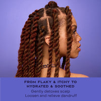 Thumbnail for SheaMoisture Anti-Dandruff Pre-Wash Apple Cider Vinegar & Salicylic Acid To Gently Exfoliate & Remove Flakes System for a Healthier Scalp 4 oz