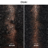 Thumbnail for OUAI Anti Dandruff Shampoo - Soothing Salicylic Acid Shampoo for Flaky, Dry and Itchy Scalp - Reduces Itching, Redness and Irritation - Sulfate Free Scalp Care (10 Fl Oz)