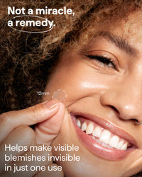 Thumbnail for Remedy for Pimples | 36 Hydrocolloid Pimple Patches for Blemishes, Zits, Spot Concealing | Near-Invisible Medical-grade Blemish Patches | By Dermatologist Dr. Shah