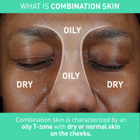 Thumbnail for CeraVe Balancing Air Foam Face Wash, Foaming Facial Cleanser For Combination Skin, 8HR Oil Control + 24HR Hydration, Fragrance-Free & Non-Comedogenic, With Glycolysine™ & 3 Essential Ceramides, 8oz