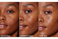 Thumbnail for e.l.f. SKIN Gentle Peeling Exfoliant, Cleanser, Effective, Easy to Apply, Peels Away Dead Skin, Removes Dirt, Ideal for All Skin Types