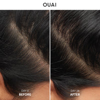 Thumbnail for OUAI Detox Shampoo (10 fl oz) & Anti-Dandruff Deluxe Size (1 fl oz) Bundle - Soothing, Clarifying Shampoo Set for Dry, Flaky Scalp - Removes Dirt & Build Up (2 Count)
