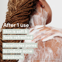 Thumbnail for Dove Serum Body Wash Acne Clear for troubled skin with Salicylic Acid 18.5 Fl Oz