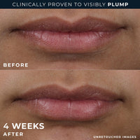 Thumbnail for RoC Derm Correxion Lip Volumizer - Lip Plumper Peptide Treatment with Hyaluronic Acid & Vitamin E + Line Smoothing Eye Cream Packette