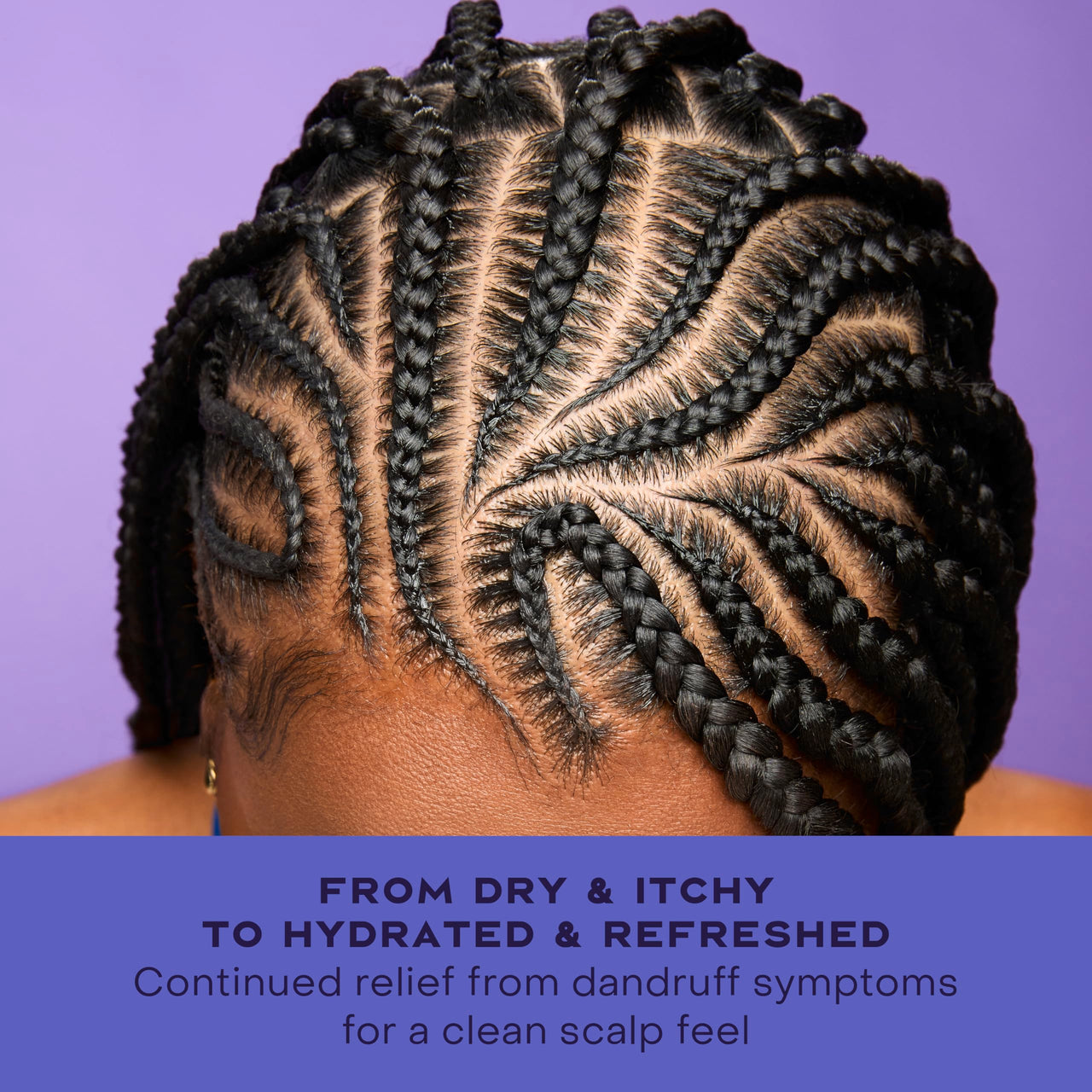 SheaMoisture Dandruff Treatment Instant Scalp Refresh Spray with Salicylic Acid & Scalp Repair Technology, Hydrates Dry Scalp & Controls Itch & Flakes, 4 fl oz