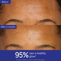 Thumbnail for Caudalie Vinoperfect Instant Brightening Dark Spot Moisturizer with Niacinamide - 1.6 Fl. Oz, Packaging may vary