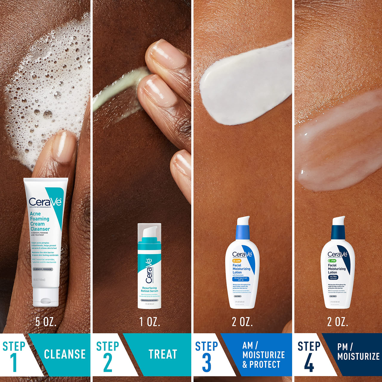 CeraVe Acne Skin Care Set, 5oz Acne Foaming Cream Cleanser + 1oz Resurfacing Retinol Serum + 2oz AM Facial Moisturizing Lotion with SPF 30 + 2oz PM Facial Moisturizing Lotion