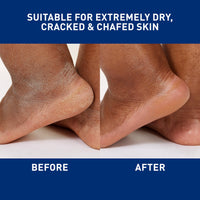 Thumbnail for CeraVe Healing Ointment, Hydrating Skin Protectant With Petrolatum, Hyaluronic Acid & Ceramides, Face & Body Skin Barrier Repair For Cracked, Chafed, Dry Skin, Fragrance Free & Lanolin Free, 3 Oz