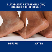 Thumbnail for CeraVe Healing Ointment - Moisturizing Skin Protectant with Hyaluronic Acid & Ceramides, 3 Oz