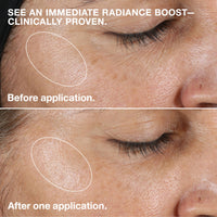 Thumbnail for Clinique 3-Step Clarifying Lotion Face Exfoliator For Dry Combination Skin Types, Dry Combination Skin, 6.7 Fl Oz