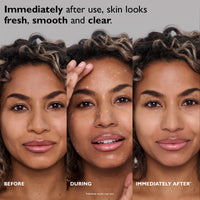Thumbnail for Peter Thomas Roth | FIRMx® Peeling Gel | Gentle Facial Exfoliant for Dullness, Pores and Uneven Texture