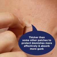 Thumbnail for PanOxyl PM Overnight Spot Patches, Advanced Hydrocolloid Healing Technology, Fragrance Free, 80 Count