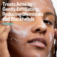 Thumbnail for Cetaphil Gentle Clear Pore Clearing Acne Cleanser, Foaming Gel Cleanser for Sensitive, Acne-Prone Skin, 8 Fl Oz Pump Bottle, 2% Salicylic Acid, Gently Exfoliates, Dermatologist Recommended Brand