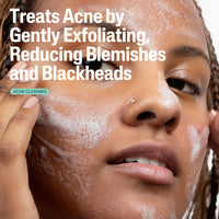Thumbnail for Cetaphil Gentle Clear Pore Clearing Acne Cleanser, Foaming Gel Cleanser for Sensitive, Acne-Prone Skin, 8 Fl Oz Pump Bottle, 2% Salicylic Acid, Gently Exfoliates, Dermatologist Recommended Brand