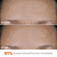 Thumbnail for Dr Dennis Gross DermInfusions Blur + Repair Cream, Instantly Blurs Fine Lines, Smooths Skin with Satin-Matte Finish, Visibly Plumps & Firms, Reduces Redness, and Improves Skin Elasticity, 1.7 Fl Oz