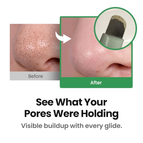 Image 3 of ilso Deep Clean Master Sebaceous Filament Care Tool for Pore Routine