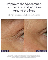 Thumbnail for Image 3 of ALASTIN Skincare Restorative Eye Complex (0.5 oz)