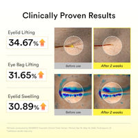 Thumbnail for Image 5 of Abib Retinal Eye Serum Lifting Roller 0.5 Fl Oz,15ml