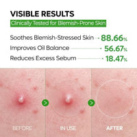 Thumbnail for Image 4 of Dr.Melaxin S-ZINC ZERO-FIT Ultra Thin Blemish Spot Patch 12mm x 72 Patches (Pack of 2)