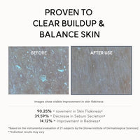 Thumbnail for Image 7 of ARENCIA Eraser Shot Serum Glycolic Acid Booster with AHA BHA, Exfoliating Face Serum for Pore Care & Texture Refining, Lightweight Daily Skincare, 30 mL / 1.01 fl. oz.