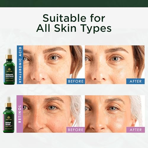 Image 3 of Tree of Life Face Serum Skin Care Set, Hyaluronic Acid & Retinol Serum