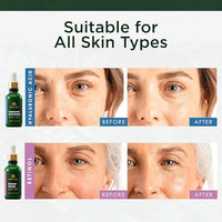 Thumbnail for Image 3 of Tree of Life Face Serum Skin Care Set, Hyaluronic Acid & Retinol Serum