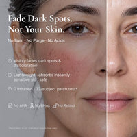 Thumbnail for Image 2 of EnaSkin Dark Spot Corrector & Remover Serum for Face & Body, Niacinamide