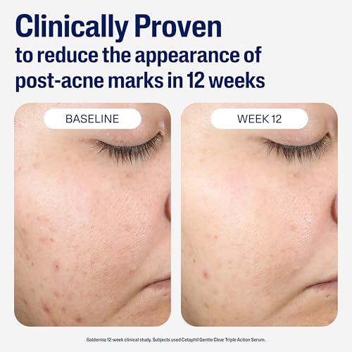 Image 5 of Cetaphil Gentle Clear Post-Acne Skin Serum, Bakuchiol Retinol Alt, 1oz